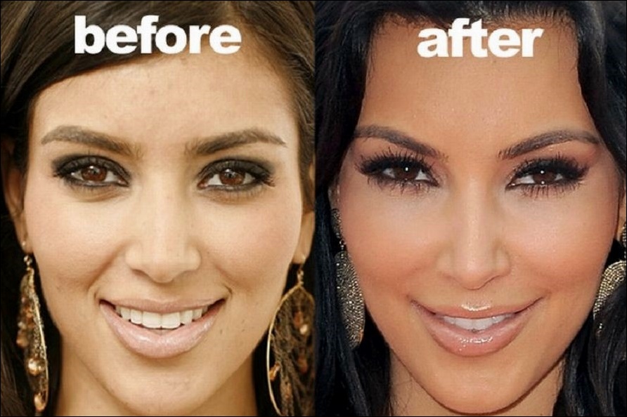 Kim Kardashian Vorwürfe der plastischen Chirurgie  