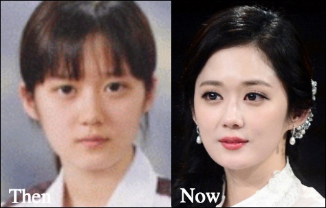 Jang Nara Plastische Chirurgie vor und nach Facelift, Augenlid Fotos  