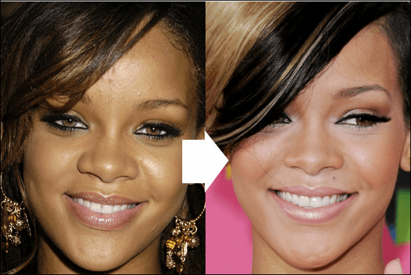 Rihanna Stirn reduzieren Größe Chirurgie vor und nach Fotos  