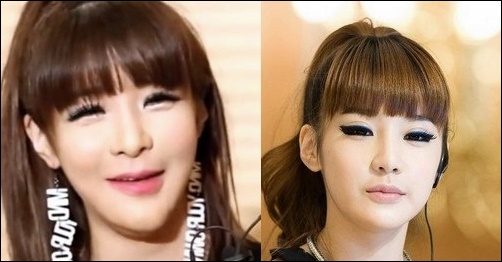Koreanische Prominente vor und nach der plastischen Chirurgie Fotos  