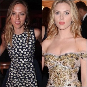 Scarlett Johansson Plastische Chirurgie Vorher und Nachher  