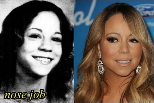 Mariah Carey vor und nach der plastischen Chirurgie  