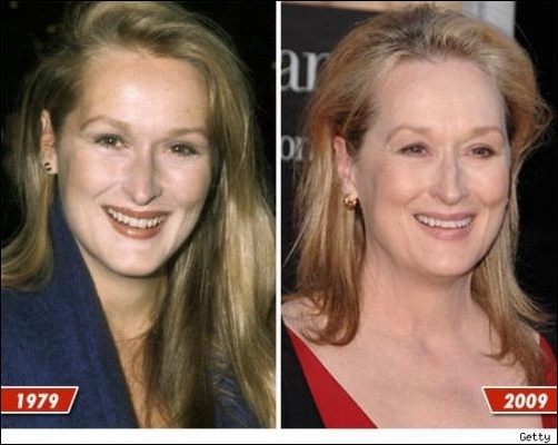 Meryl Streep Plastische Chirurgie vor und nach  