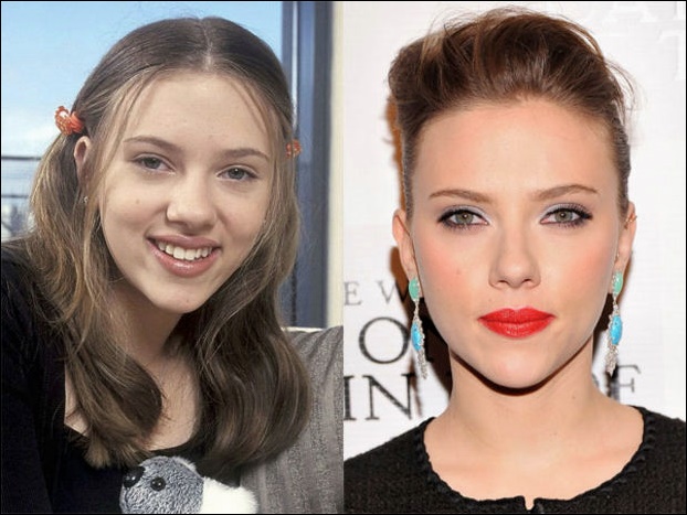 Scarlett Johansson Nose Job vor und nach Nasenkorrektur Fotos  