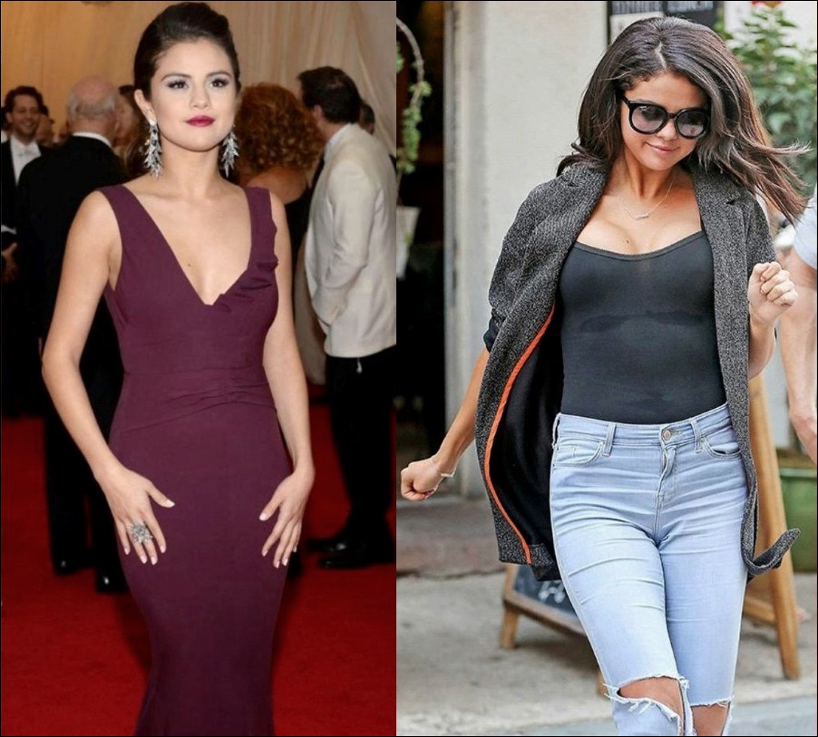 Selena Gomez Plastische Chirurgie für ältere Looks!  