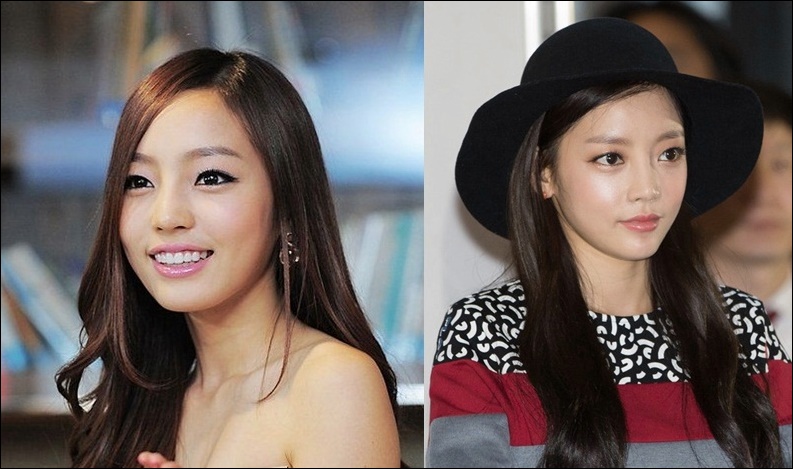 Goo Hara Plastische Chirurgie Vorher-Nachher Bilder  