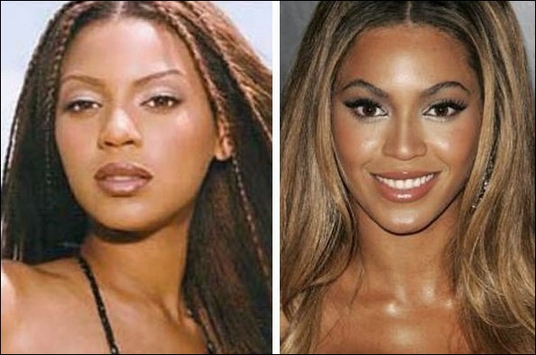 Beyonce Plastische Chirurgie - Leichtere Haut und größere Brüste!  