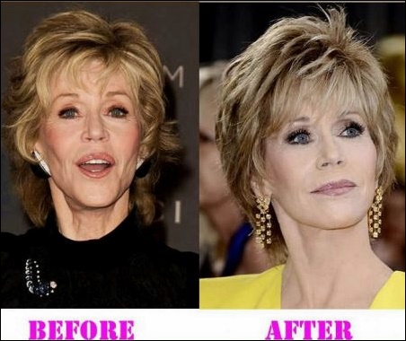 Jane Fonda Plastische Chirurgie ging gut  