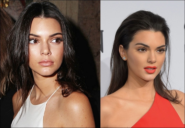 Kendall Jenner Nase Job Plastische Chirurgie vor und nach Fotos  