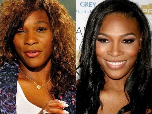 Serena Williams Plastische Chirurgie für Tennis Superstar?  