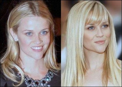 Reese Witherspoon Plastische Chirurgie vor und nach Gesicht Fotos  