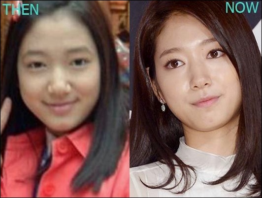 Park Shin Hye leugnet immer noch plastische Chirurgie?  