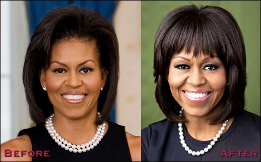 Michelle Obama Plastische Chirurgie vor und nach  