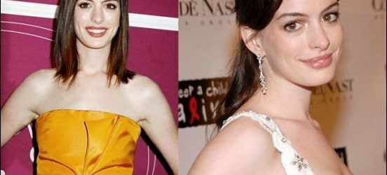 Anne Hathaway Plastische Chirurgie vor und nach  