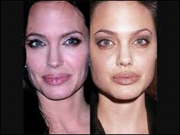 Angelina Jolie Gesicht Plastische Chirurgie vor und nach der Nase Job  