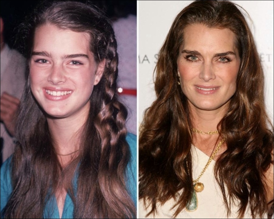 Brooke Shields sieht wunderschön aus.  Plastische Chirurgie geholfen?  