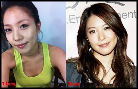 Boa Kwon Plastische Chirurgie vor und nach Kosmetik Fotos  