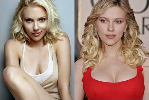 Scarlett Johansson Nase Job und Brustimplantate  