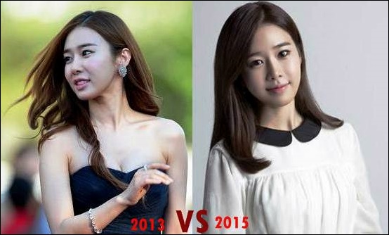 Yoo In Na Plastische Chirurgie vor und nach Fotos, Bilder  