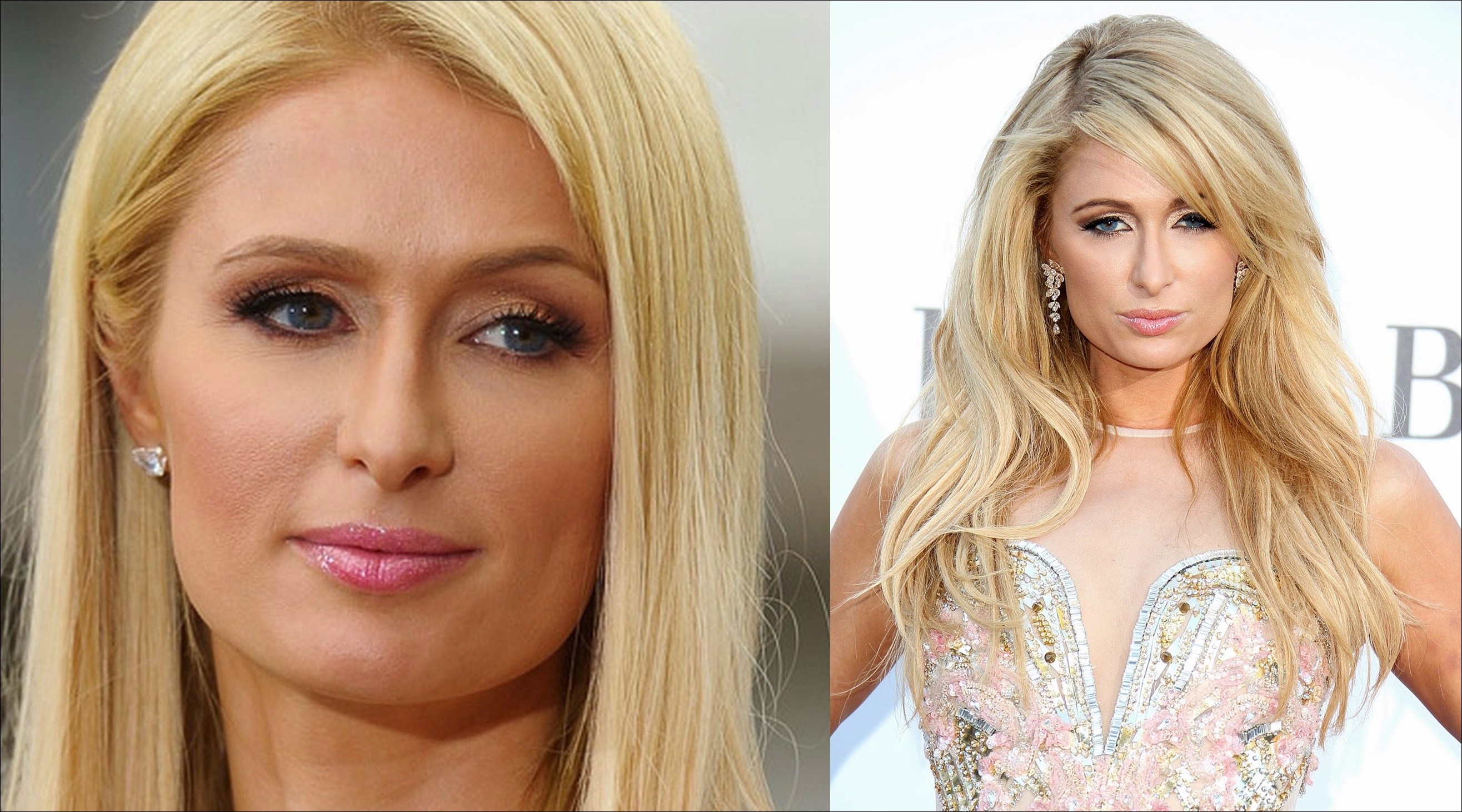 Paris Hilton Nase Job Plastische Chirurgie vor und nach Nasenkorrektur Fotos  