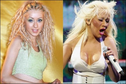Christina Aguilera Brustvergrößerung Vorher-Nachher Fotos  