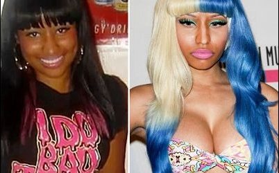 Nicki Minaj Plastische Chirurgie vor und nach  