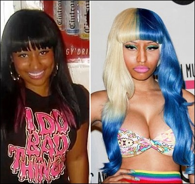 Nicki Minaj Plastische Chirurgie vor und nach  